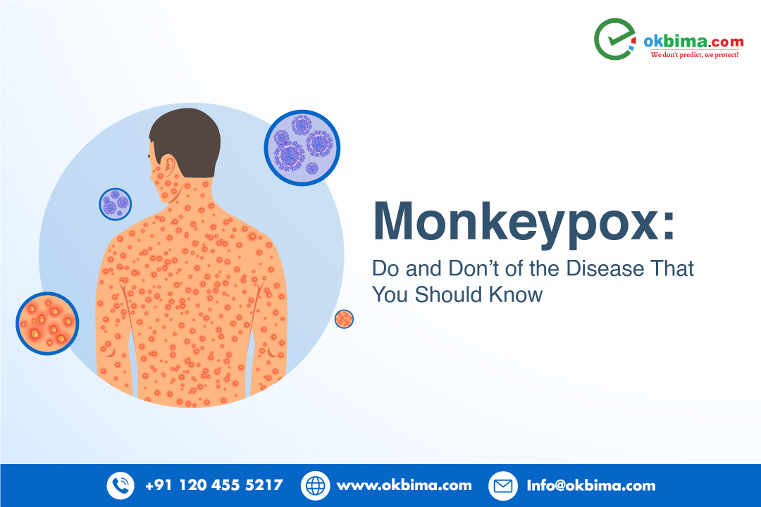 Monkeypox: Dos And Don'ts Of The Disease That You Should Know